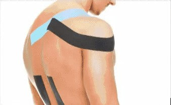 Kinesiology tape on a shoulder and back (illustration)